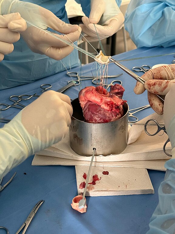 Ein chirurgisches Team führt einen Eingriff durch, bei dem ein Herz in einem Behälter gehalten wird. Die Hände der Chirurgen sind mit Handschuhen geschützt und sie verwenden chirurgisches Nahtmaterial und Instrumente. Blutige Gewebereste sind auf dem Tisch zu sehen.