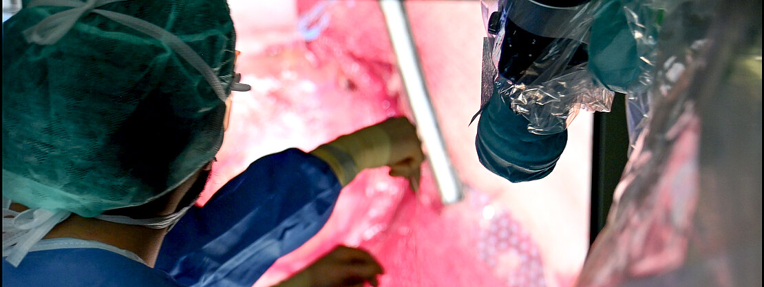 Operationssaal: Ein Chirurg blickt auf einen großen Bildschirm mit Endoskopie-Aufnahme von Gewebe. Mehrere Instrumente arbeiten minimalinvasiv; ein abgedecktes Kamerasystem unterstützt die präzise Führung während des Eingriffs.