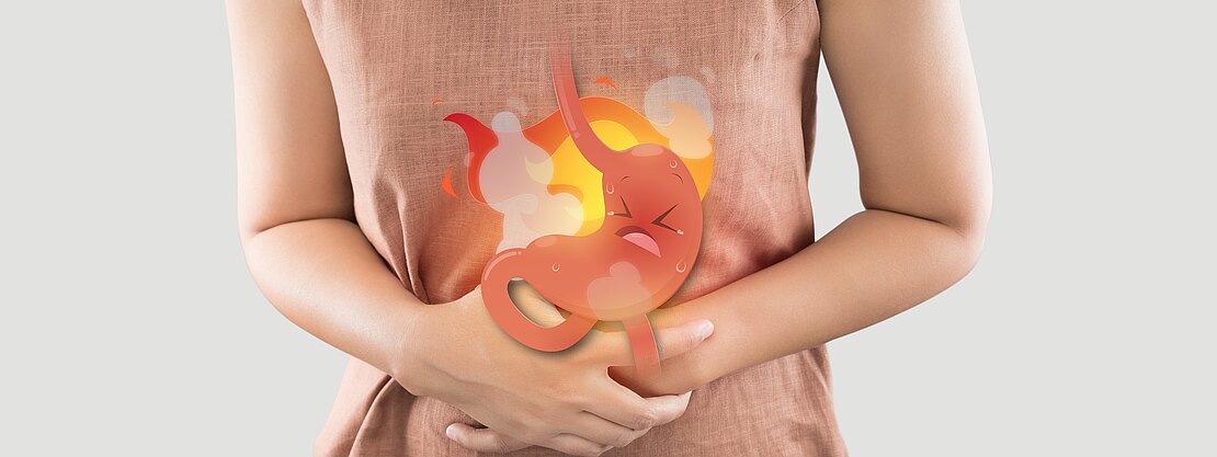 Person hält sich den Bauch; über dem Magen ist eine brennende, schwitzende Cartoon-Darstellung eingeblendet. Bild symbolisiert Sodbrennen, Magenschmerzen oder Verdauungsbeschwerden.