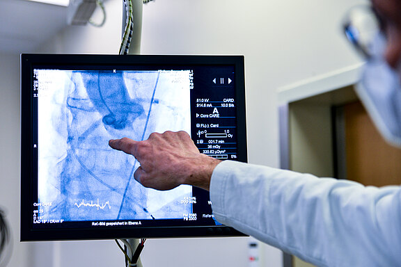 Hand eines Arztes zeigt auf Monitor mit angiografischer Röntgenaufnahme des Brustkorbs; sichtbare Herzkranzgefäße und Katheter, verwendet für kardiologische Diagnose oder Intervention.