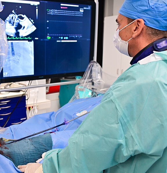 Mediziner in OP-Kleidung führt einen minimalinvasiven Kathetereingriff durch und überwacht dabei Echtzeit-Bildgebung und Vitaldaten auf großen Monitoren; der abgedeckte Patient liegt auf dem Tisch.