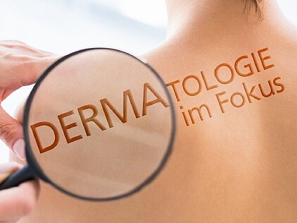Lupe über nackter Rückenhaut; auf der Haut steht „DERMATOLOGIE im Fokus“. Symbolisiert eine sorgfältige Hautuntersuchung und dermatologische Vorsorge.