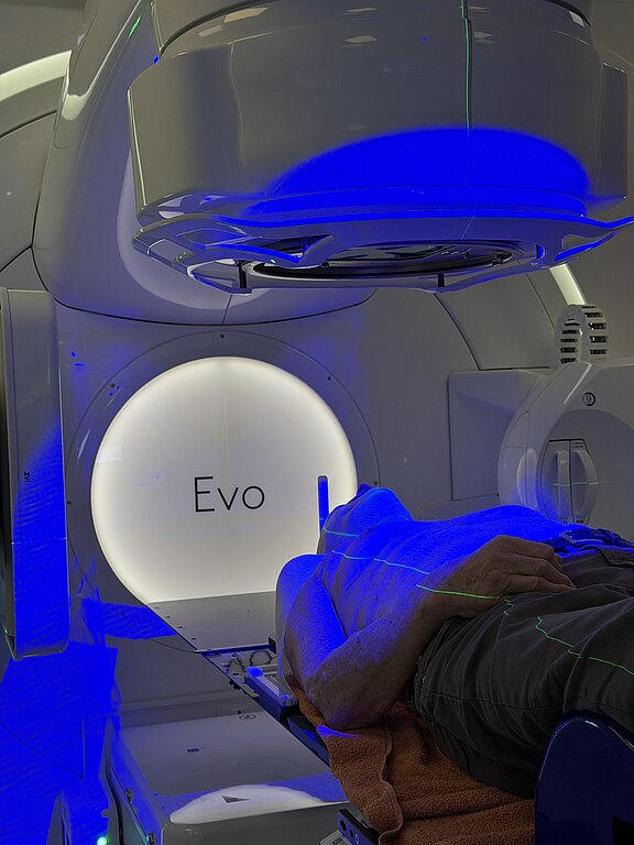 Patient liegt auf einem Behandlungstisch unter einem großen Strahlentherapiegerät. Blaue Laserlinien zur Positionierung markieren den Körper. Die Aufschrift „Evo“ leuchtet am Gerät. Darstellung einer präzisen Bestrahlung im Krankenhaus.